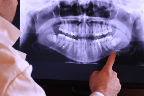 Best 24-Hour Emergency Dental Care in Edna, TX
